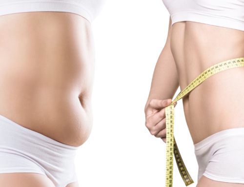 Weight Gain After Liposuction Surgery